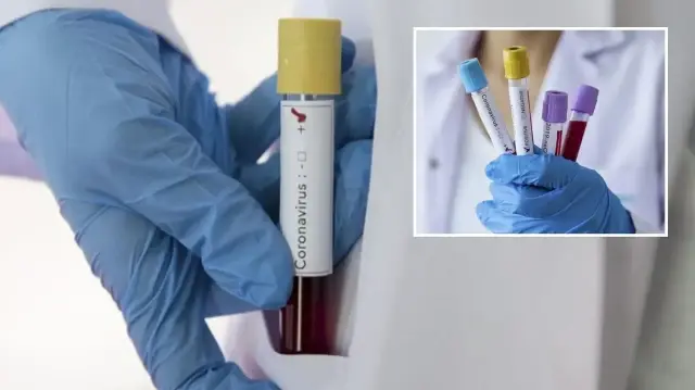 zayiflar kovid 19u daha agir geciriyor 8n38WPF1.webp